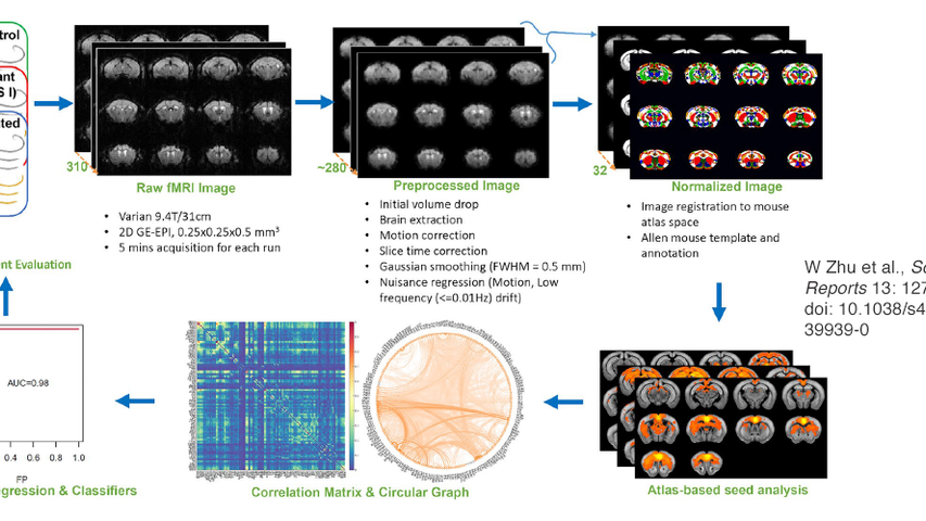 Graphic showing the resting state functional magnetic resonance imaging data analysis pipeline